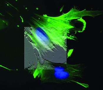 Atomic force microscopy image of a cell overlaid on a fluorescence microscopy image of the same cell