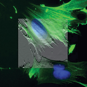 Atomic force microscopy image of a cell overlaid on a fluorescence microscopy image of the same cell